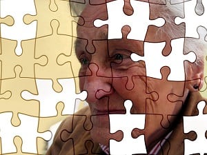 diagnosis of Alzheimer's